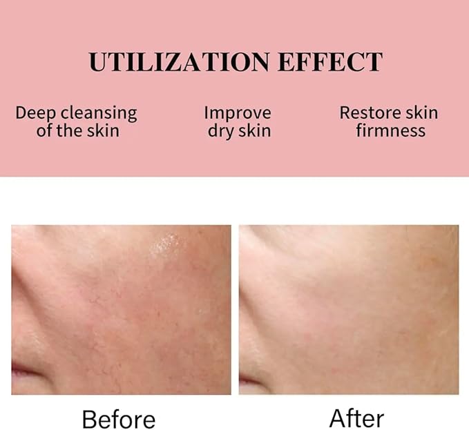 Generic 5 in 1 Glow Niacinamide Collagen Anti Aging Toner - Face Mist Hydrating Spray with Vitamin E & C Skin Care Facial Toner, Plump, Smooth, Moisturize Reduce Wrinkles & More., Pink