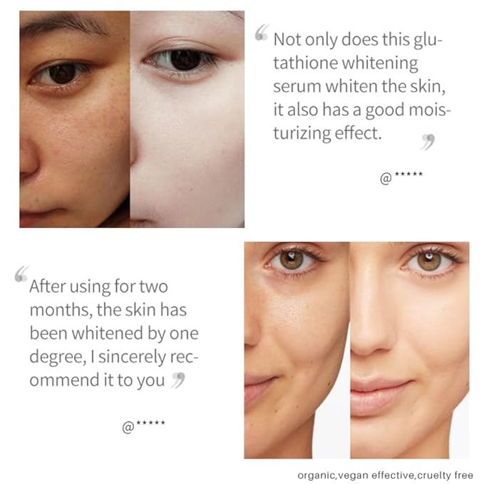2PCS Glutathione Whitening Freckle Serum Remove Melasma Dark Spot Removal Gentle Brightening Moisturizing