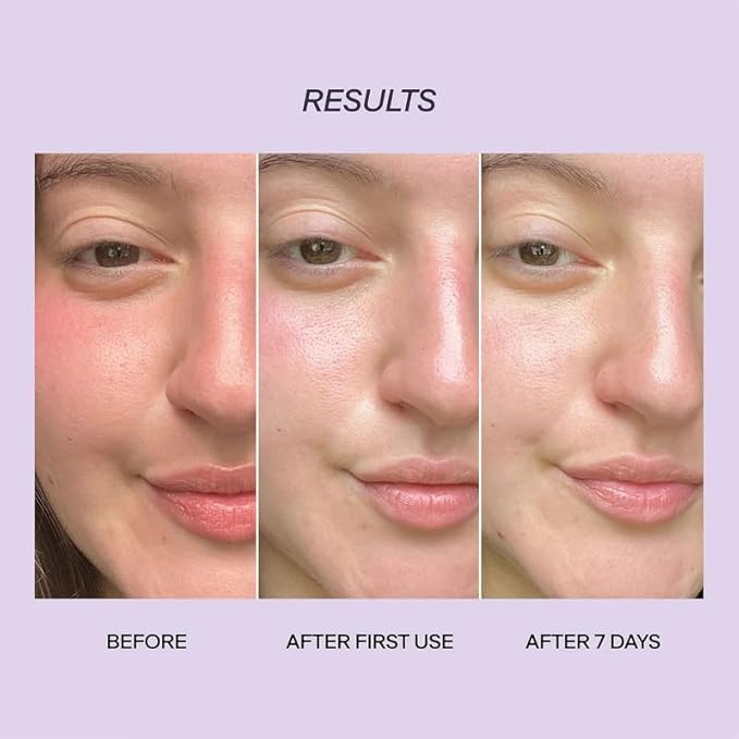 Provence Beauty BARE LUMIÈRE Skin Barrier Repair Cream – 5-in-1 Face Moisturizer with Ectoin, Encapsulated Probiotics & Aloe Vera – Hydrates, Primes, Boosts Glow & Strengthens the Skin – 2 fl oz