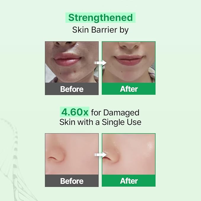 Zipiderm EGF Skin Barrier 4-Step Repair Set – Milky Toner, Hydrating Ampoule, Intensive Cream & Dressing Sheet Mask | Ceramide, Panthenol & Bio-EGF Korean Skincare Routine for Damaged, Dry & Sensitive
