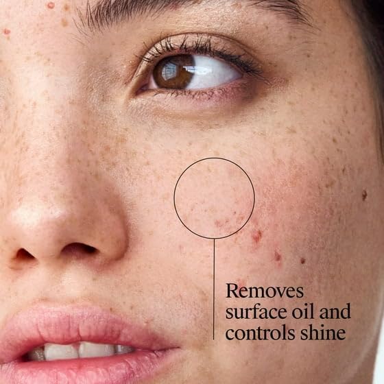 Oil Eliminating Neutogena Acne Treatment Astringent Toner for Face, Salicylic Acid Pore Cleanser, Clears Breakouts, Controls Oil, 8 oz