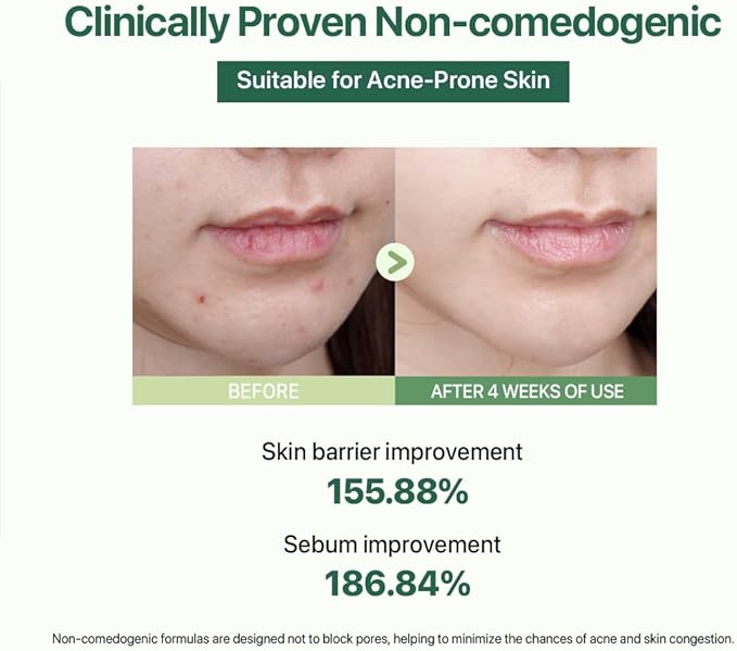 Le Nubele Azulene CICA Skin Toner for Clear Skin, Azulene 600ppm, Centella Asiatica 5000ppm, Hydrating, Non-Comedogenic, Calming, Redness Relief, Fungal Acne Safe, Korean Skin Care, 120ml/4.05 fl.oz.