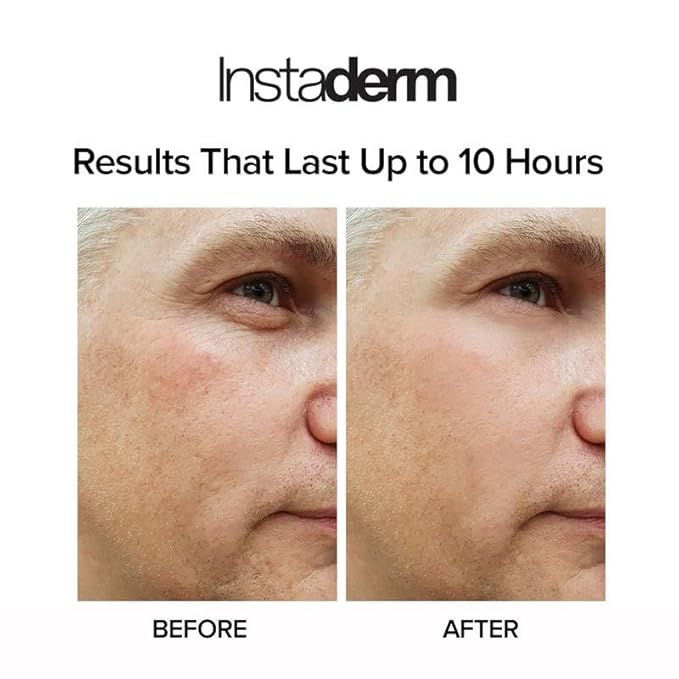 Instant Eye Tightener – Removes Under Eye Bags & Puffiness. Eliminate Dark Circles & Wrinkles. Naturally Ageless Hydrating Cream. Disappears Before Your Eyes Within Minutes.