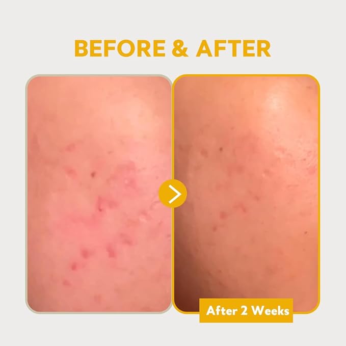 TIRTIR Pure Vitamin C 24% Serum 30ml + Milk Skin Toner 150ml