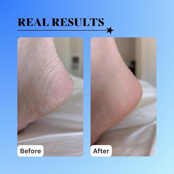 10% Glycolic Exfoliating Treatment Tonic (1oz)