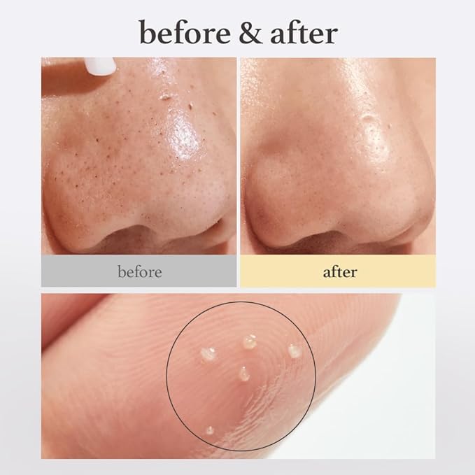 NOONI Facial Toner Pads - Glycolic Acid Pads 80 EA + Facial Cleanser - Snow Aqua 0 LHA Toning Cleansing Oil, 6.76 Fl Oz (200 ml) Bundle
