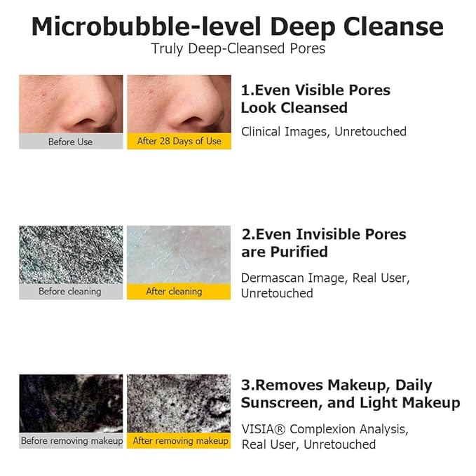 Dual-Tube Amino Acid & White Clay Face Wash - Deep Pore Cleanser for Oily Skin - Blackhead & Makeup Remover - Skincare Gifts for Her