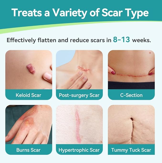 Dimora Medical Grade Silicone Scar Sheets -Ultra Soft Silicone Scar Tape (1.6”x60" Roll), Hypoallergenic Scar Removal Treatment for Surgical Scars, C Section, Tummy Tuck, Keloid Treatment