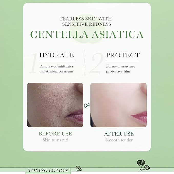 BIOAQUA Centella Asiatica Soothing Dryness Repair Toner Hydration Oil Control Anti-Acne Moisturizing Skincare 120ml/4.06fl.oz