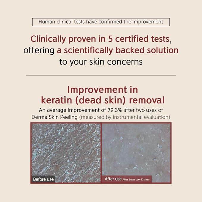 [BQCELL] [Made In Korea] [DERMA SKIN PEELING 2g / Recell Cure Serum 2ml, Safety Cap 1ea, 3set], Acne Skin Available, Exfoliating, Facial Scrub, Korean Beauty, Blackhead Remover