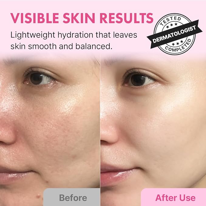 Hanskin Pore Care & Hydration Routine Set – BHA Cleansing Oil, Hyaluron Essence Toner, Pink Lotus Vegan PDRN Serum & Hyaluron Moisture Cream | 4-Step Glass Skin Skincare for Oily & Combination Skin