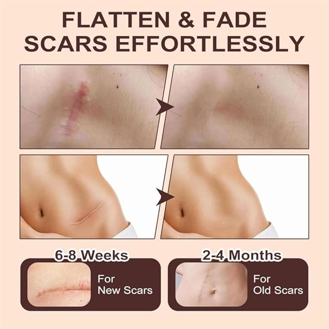 Scar Solution Stick, Silicone Scar Stick, 2pcs Moisturize Smoothing Skin Care Balm For Reducing Appearance Of Face Body, Suitable For All Skin Types