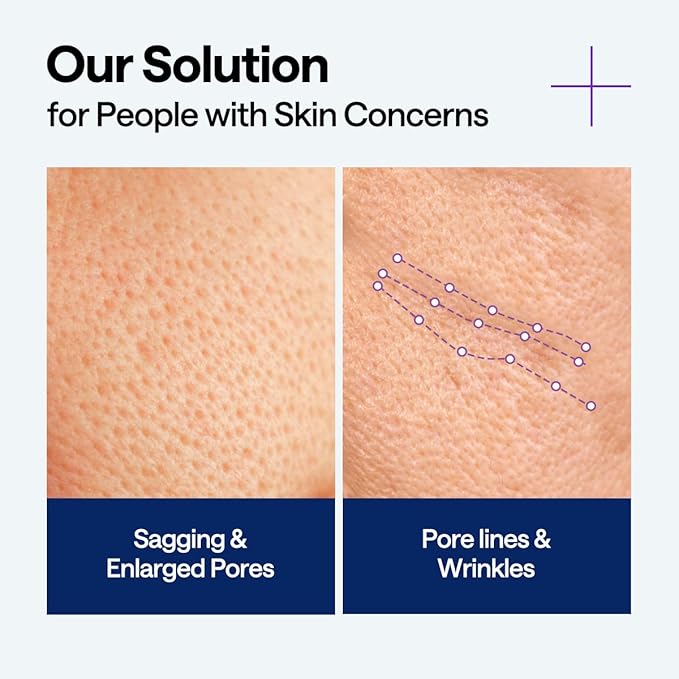 Mediheal PDRN Glass Skin Lifting Bundle – Stretchable Toner Pads (100ct) + PDRN Lifting Serum + Derma Cream | Pore Care, Firming & Deep Hydration