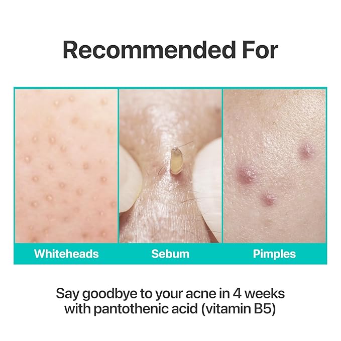 numbuzin No.1 Pantothenic B5 Active Soothing Cream | Remove sebum and skin troubles, Pantothenic acid, Korean Skincare Gift for Women | 2.70 fl oz