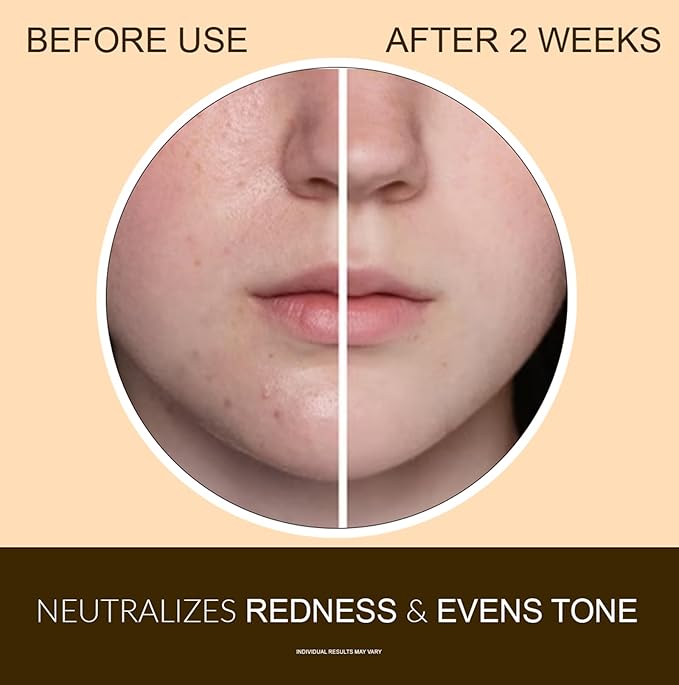 Glycolic Acid 7% Toner - 120 ml Exfoliating Facial Toner, Pore Minimizing, PH Balancing, Alcohol-Free Formula for All Skin Types,Use Daily for Refreshing and Hydrate Skin