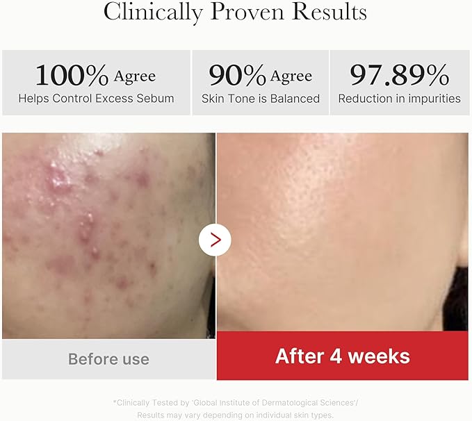 medicube Clarifying Pad & Soothing Cream Duo: Red Succinic Acid Pad and 3H Daily Daily Moisturizer | Gentle Exfoliation for Clearer, Radiant Skin | Balance & Comfort Care Routine