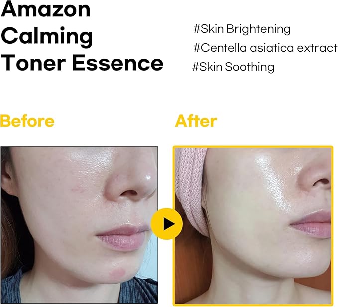 Brazilian Amazon Rainforest Red Propolis Soothing Toner, K- Beauty, Hydrating, Calm Redness, Glow Toner for Radiant Skin, Non Comedogenic, All in One, Suitable for All Skin Type, 4.06 fl. oz.