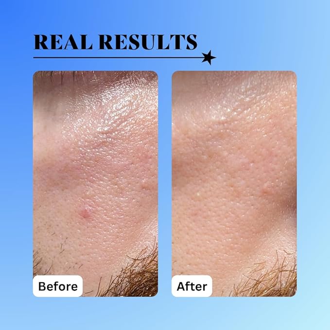 10% Glycolic Exfoliating Treatment Tonic (1oz)