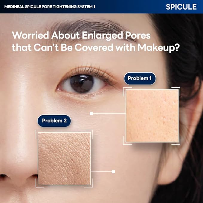 Mediheal Collagen Spicule 1000ppm Intensive Serum – Micro Needle Serum for Pore Care, Soothing & Skin Texture Improvement, 2-Step,Collagen Spicule Ampoule and Gel Mask Set,Skin Booster,4pcs
