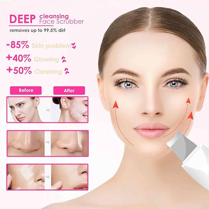 Face Scrubber, Skin Spatula, Facial Silicone Pore Cleaner, Rechargeable All Skin Types Waterproof Blackhead Remover Tools for Deep Cleansing, Exfoliating, 3 Modes Wireless, White