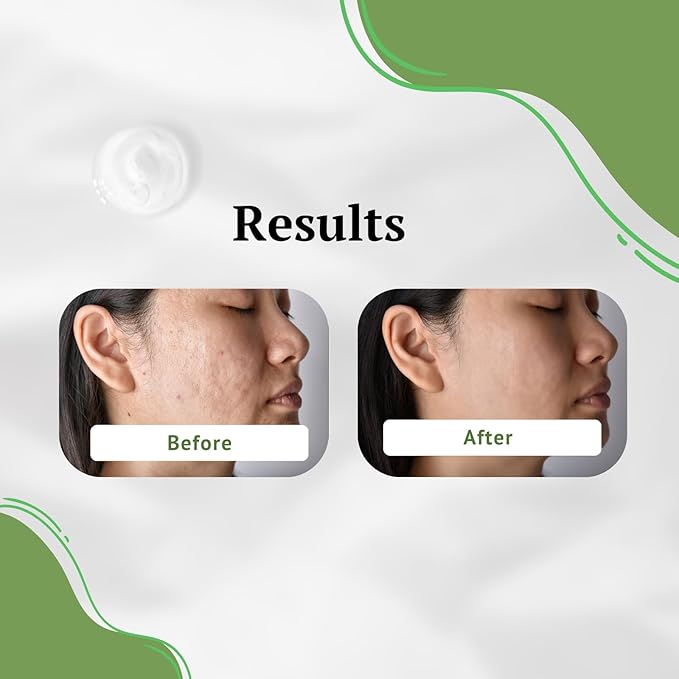 Aloe Vera Toner for Face. Skincare to Treat and Prevent Acne, Restore PH Balance & Excess Dirt. Facial Toner for Women and Men.