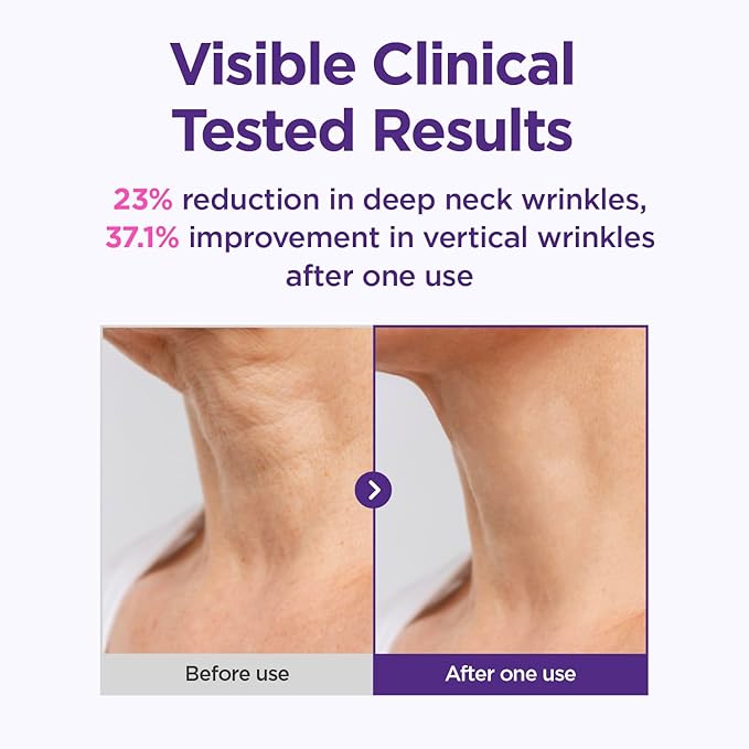 CKD Gua Sha Neck Cream Filltocshot [Refill] - Advanced Anti-Aging Neck Firming Cream with Massage Roller. Visibly Reduces Wrinkles, Lifts & Tightens Sagging Skin, Boosts Elasticity, Korean Skincare.