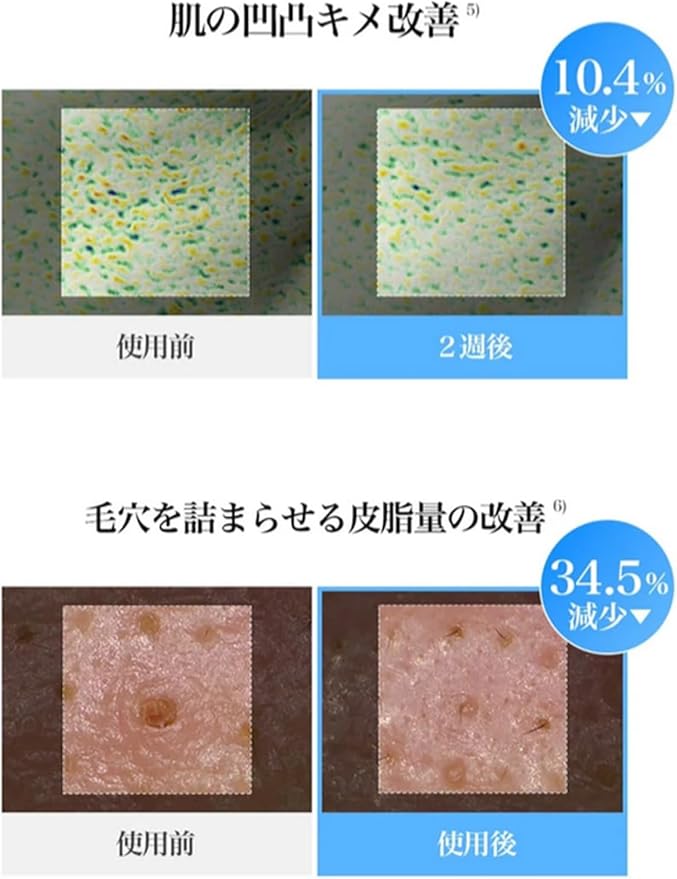 Dear Klairs EGF Blue Calming Toner Pad with Guaiazulene & CICA Exosome, Uneven Tone, Deep Hydration, Korean Exfoliating Face Skin Care, K-Beauty, 5.07 Fl Oz, 60 Pads