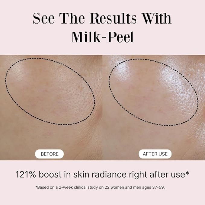 Milkpeel Toner to Essence – Gentle Daily Exfoliating, Hydrating Toner for Smooth, Radiant Skin, Strengthens Moisture Barrier, Perfect for Sensitive Skin, Balanced, Healthy Glow, 200ml