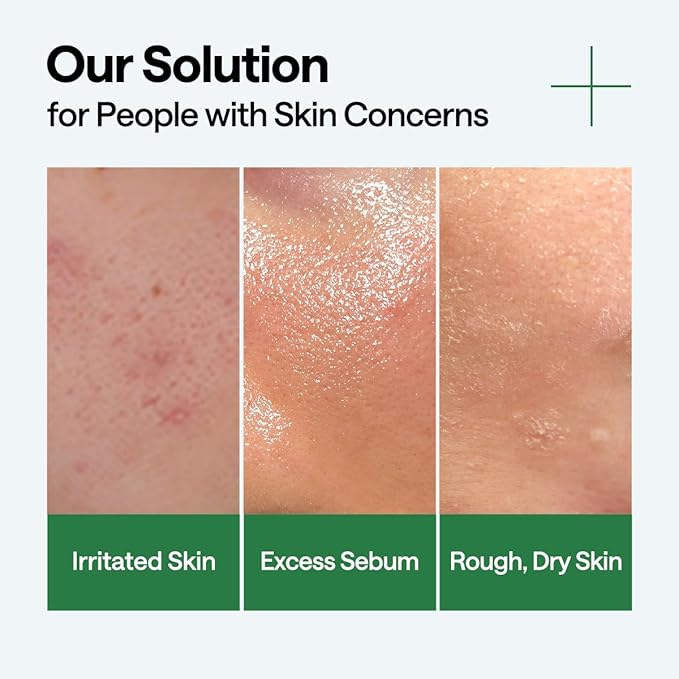 Mediheal Teatree Pad & Serum Duo Set for Quick Skin Calming & Redness Relief - Teatree Trouble Calming Toner Pads (100 Count) + Teatree Serum (1.35 fl.oz)