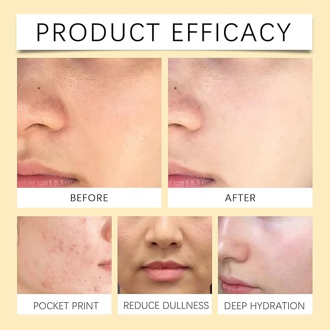 Moisturizing Toner - Deep Hydration, Fast-Absorbing, Oil-Free, Long-Lasting, Soothes Skin For Radiance(2PCS)