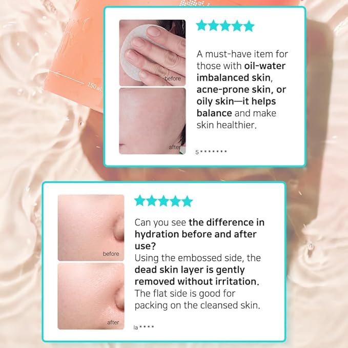 Elishacoy | TETRAFORCE Cica Peeling Toner Pads, Gentle Exfoliating & Calming Toner with Cica, Daily Skin Smoothing & Hydration, Vegan & Dermatologist Tested, 150 mL