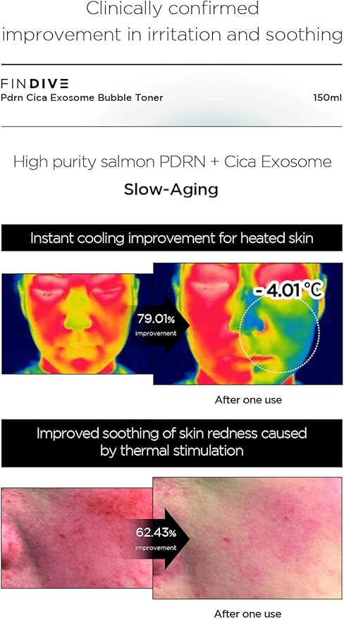 FINDIVE Official PDRN CICA Exosome Bubble Toner, PDRN (Sodium DNA) 1,000ppm, CICA Exosome 1,000ppm, Marin Collagen, Soothes, Regenerates Skin, Korean Skincare 5.07fl.oz