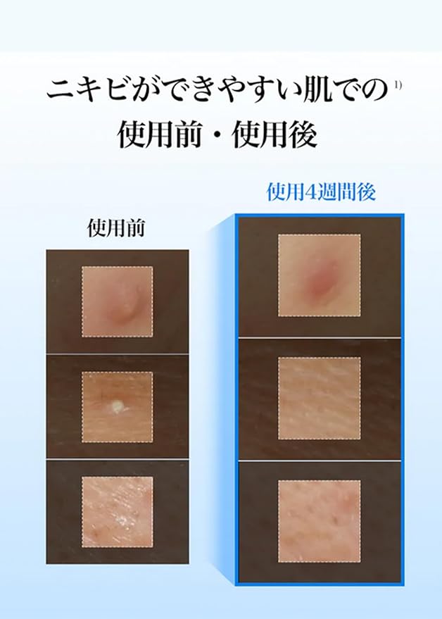 Dear Klairs EGF Blue Calming Toner Pad with Guaiazulene & CICA Exosome, Uneven Tone, Deep Hydration, Korean Exfoliating Face Skin Care, K-Beauty, 5.07 Fl Oz, 60 Pads