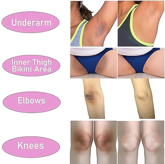Skin Lightening Cream for Intimate Area with Niacinamide, Arbutin, Tranexamic Acid and Vitamin C, Even Skin Tone for Body, Underarm, Knees, Elbows, Inner Thigh, Bikini Areas Bleaching Whitening Cream