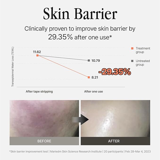 Silver Shield Mist - Facial Barrier Toner Spray, 80% Witch Hazel Water, Centella Asiatica for Skin Barrier Repair, Recovery Calming Mist for Sensitive Skin, Korean Skin Care (11.16 fl oz)