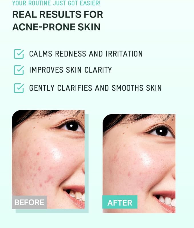 BRING GREEN Tea Tree CICA Soothing Toner | Mild Daily Skincare Routine for Cooling and Hydrating Effect (8.5 Fl. Oz., 250ml)
