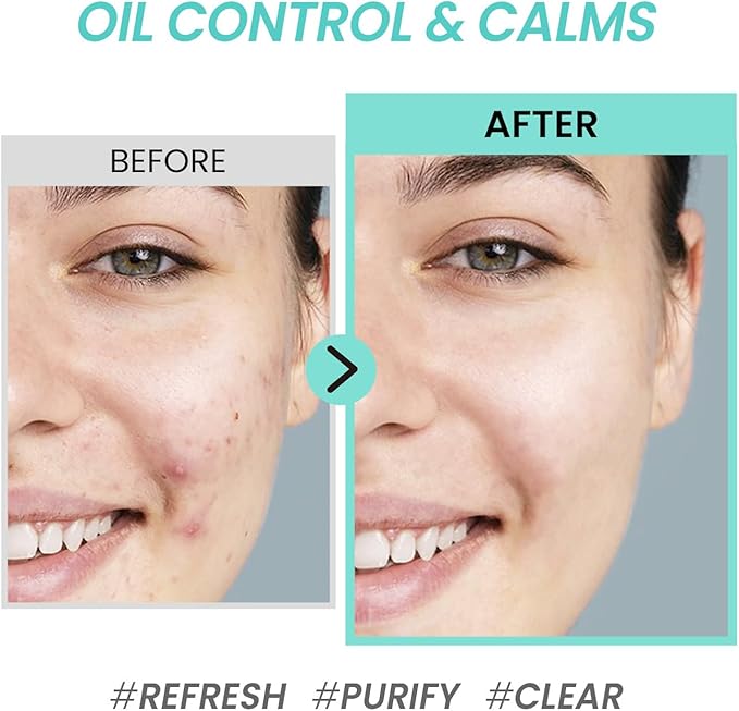 coxir Tea Tree Pore & SEBUM Emulsion for Oil Balance, Pore Minimizer, sebum Control Paraben Free, Cruelty Free, Korean Skin Care [100ml/3.38 fl.oz]