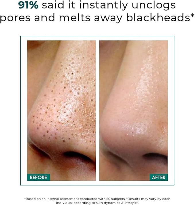 Concious Chemists Blackhead Melting Water | 100ml | Gentle Pore Treatment with Succinic, Glycolic Acid & CICA Exosome | Unclogs Pores, Dissolves Blackheads & Smoothens Skin | Toner for Men & Women