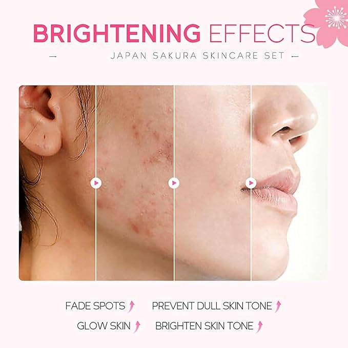 Skin Care Set for Women Girls, Cherry Blossoms Beauty Gift Sets Skin Care Kit with Cleanser, Face Serum, Face Cream,Toner,Eye Cream（5pcs Skin Care Kit）