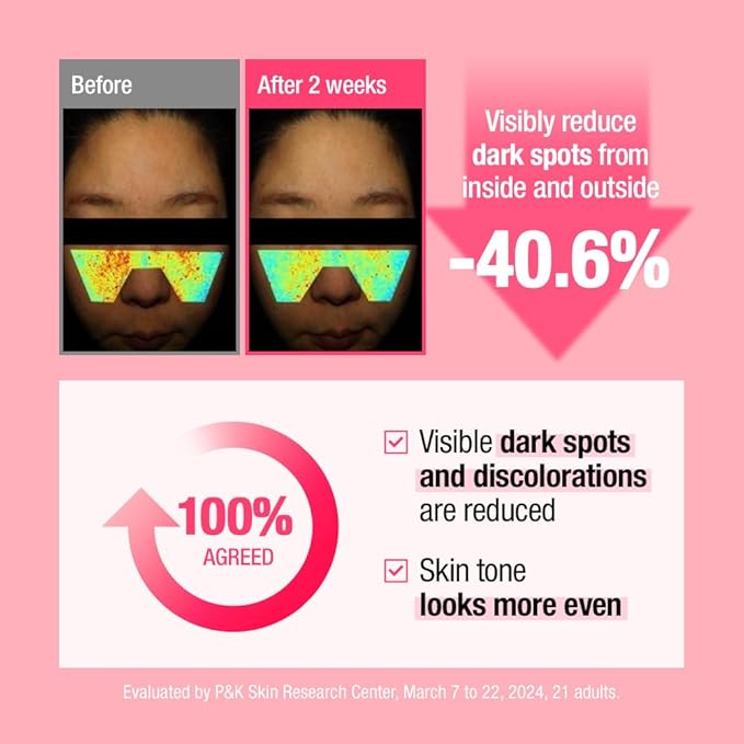Spot Pink Vitamin Serum, 1.01 fl oz - B12 Vitamin Serum for Face I Niacinamide Facial Serum for Dull Skin & Uneven Skin Tone I Glass Skin Korean Skincare