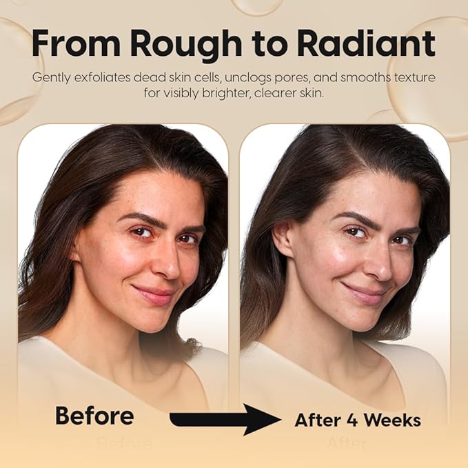 2% Salicylic Acid Blemish & Dark Spot Serum+Toner-Minimizes Pores, Ingrown Hair&keratosis Pilaris–Face&Body, Oily & Combination Skin-with Niacinamide, Alpha-arbutin &Witch Hazel 6.8 FL Oz