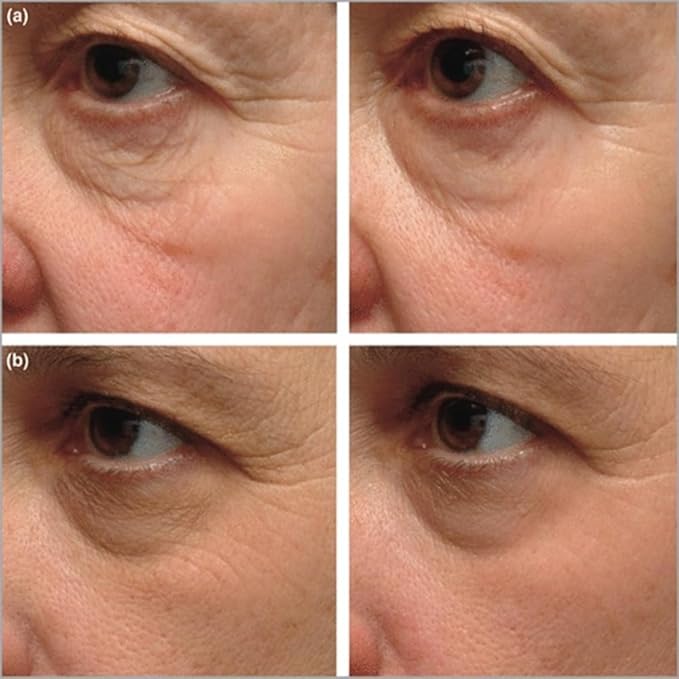 Instant Firming Eye Serum, Anti-Aging Formula for Under Bags and Wrinkles, Under Eye Cream-10ml,0.35 oz, Wrinkle Filler, Visibly Improves for Bags Dark Circles Treatment for Puffines (Scented)