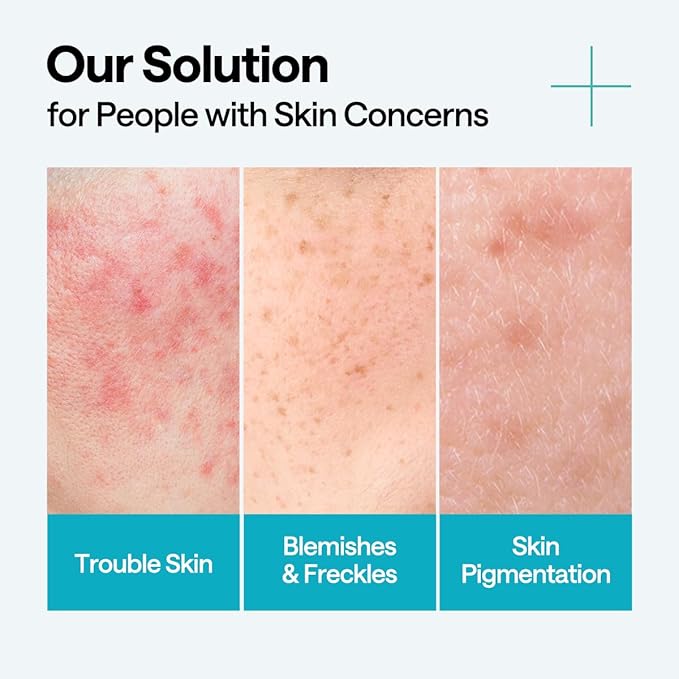 Mediheal Madecassoside Clear Skin Routine Bundle – Cream Pack Cleanser + Blemish Toner Pads (100ct) + Repair Serum | Centella Asiatica Tone Care, Pore Cleansing & Skin Soothing