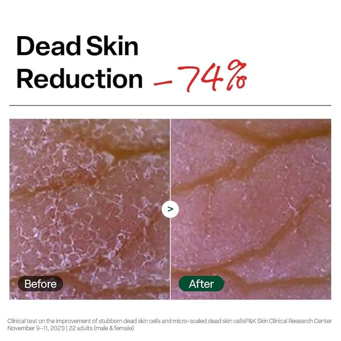Dr. G Brightening Peeling Gel - Korean Skincare for Glowy Skin - Aqua Gommage Facial Exfoliator - Hyaluronic Acid, Ceramides, Vitamin C - Smooth Skin Texture, Low Irritation - Bulk Items - 4.23 fl oz