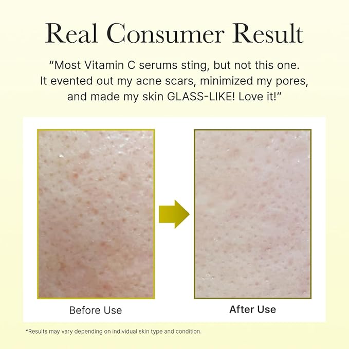 Arencia Vitamin C Booster Shot Serum with Glutathione, Niacinamide and Vitamin E for Dark Spot Care, Fine Lines & Wrinkles, Glass Skin, Korean Skincare 10ml/0.33 fl.oz