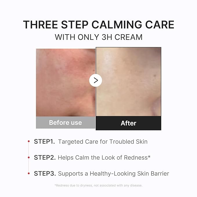 medicube Calming & Barrier Comfort Duo: 3H Daily Relief Cream and Hypochlorous Acid Power Soothing Spray | Daily Soothing & Post-Care Hydration Routine