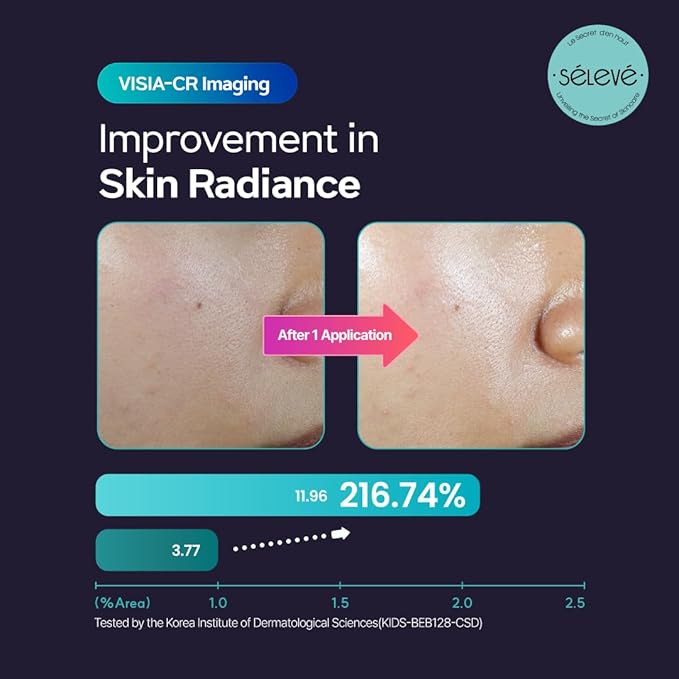 Glow Caviar Bubble Toner – Hydrating & Glow Face Toner with Green Caviar Liposomal, Niacinamide, Panthenol & Ferulic Acid, Sensitive & Dry Skin, Korean Skin Care (3.38 fl.oz / 100ml)