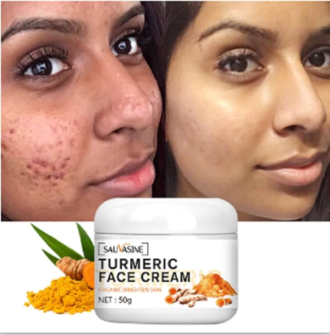 Lanthome Turmeric Face Cream for Face Care Anti-Aging Cream Brightening Face Moisturizer Cream,Skin Repair,Turmeric Moisturizing Cream for Dark Spots Remover,Evens Skin Tone-50g