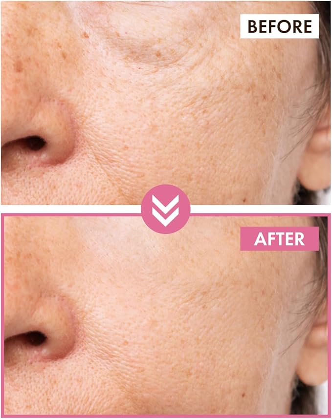 It's Skin Peptide Collagen Toner 5.07 Fl Oz | Moisturizing Toner with Organic Collagen Peptides | Hydrating Toner for Sensitive Skin | Organic Skin Care & Face Brightening Toner | K Beauty Toner