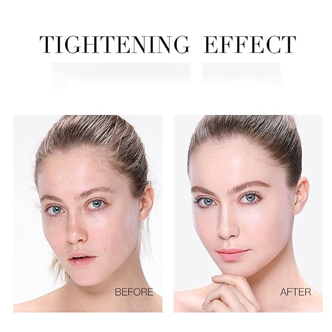 Soluble Protein Thread Lifting Set, Nano Gold Essence & Absorbable Collagen Silk Peptide Threads for Face, Hydrating & Firming Skin Care Kit, Reduces Appearance of Fine Lines & Wrinkles